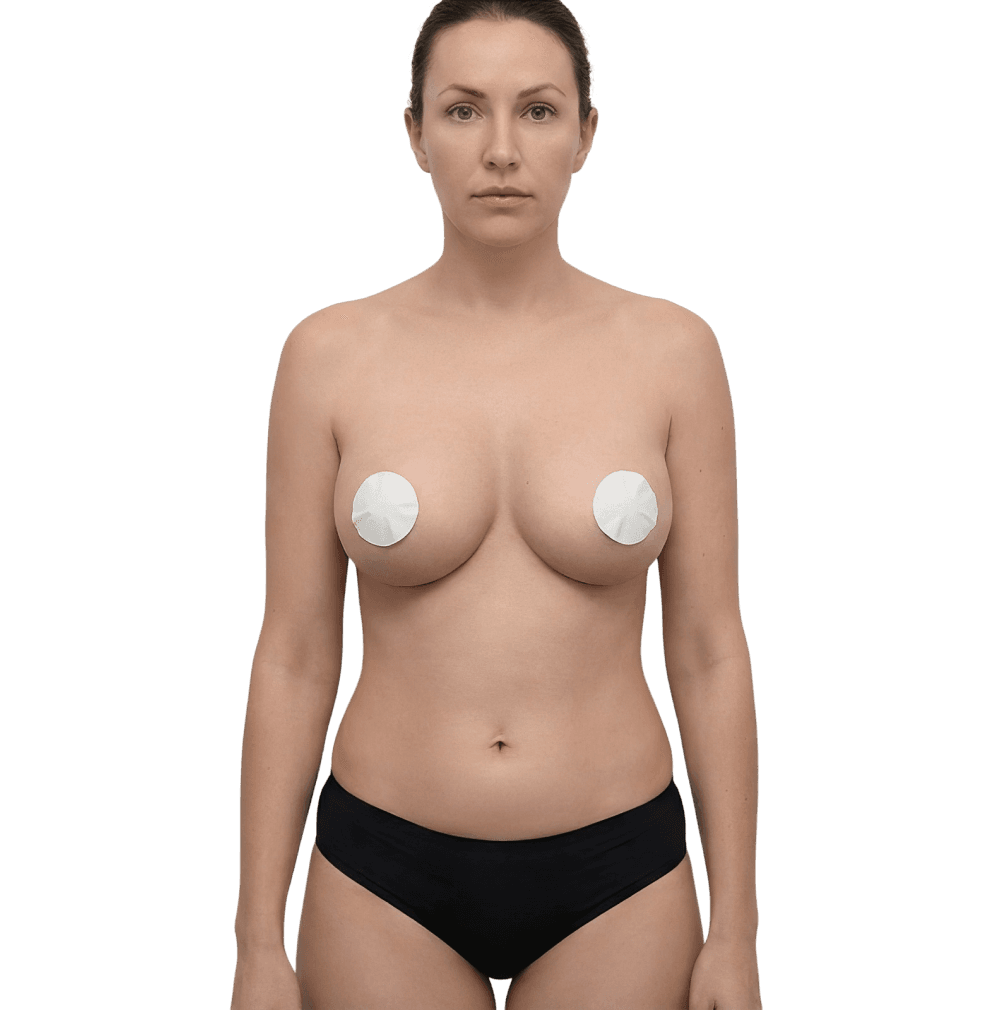 Breast Augmentation after