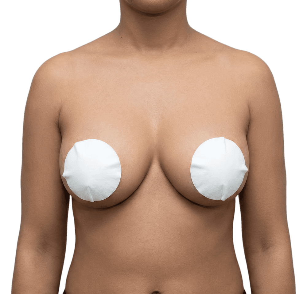 Breast Reduction after