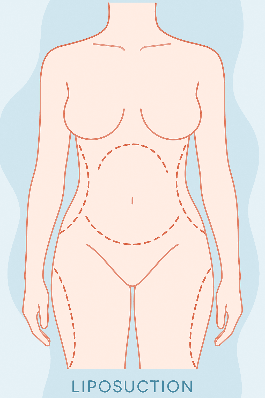 procedure intro