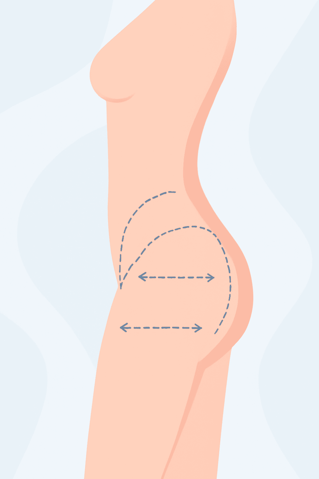procedure intro