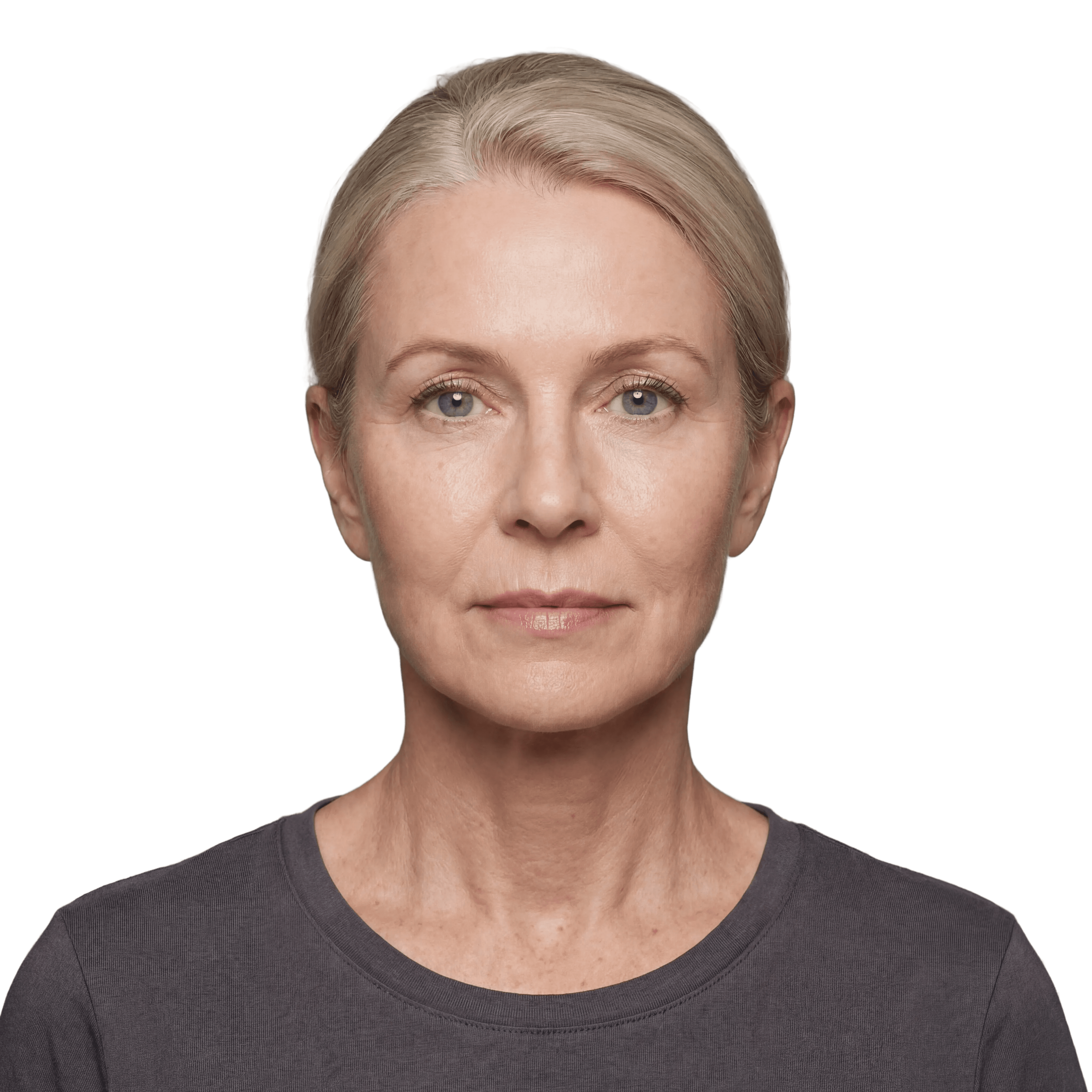 After — representative result