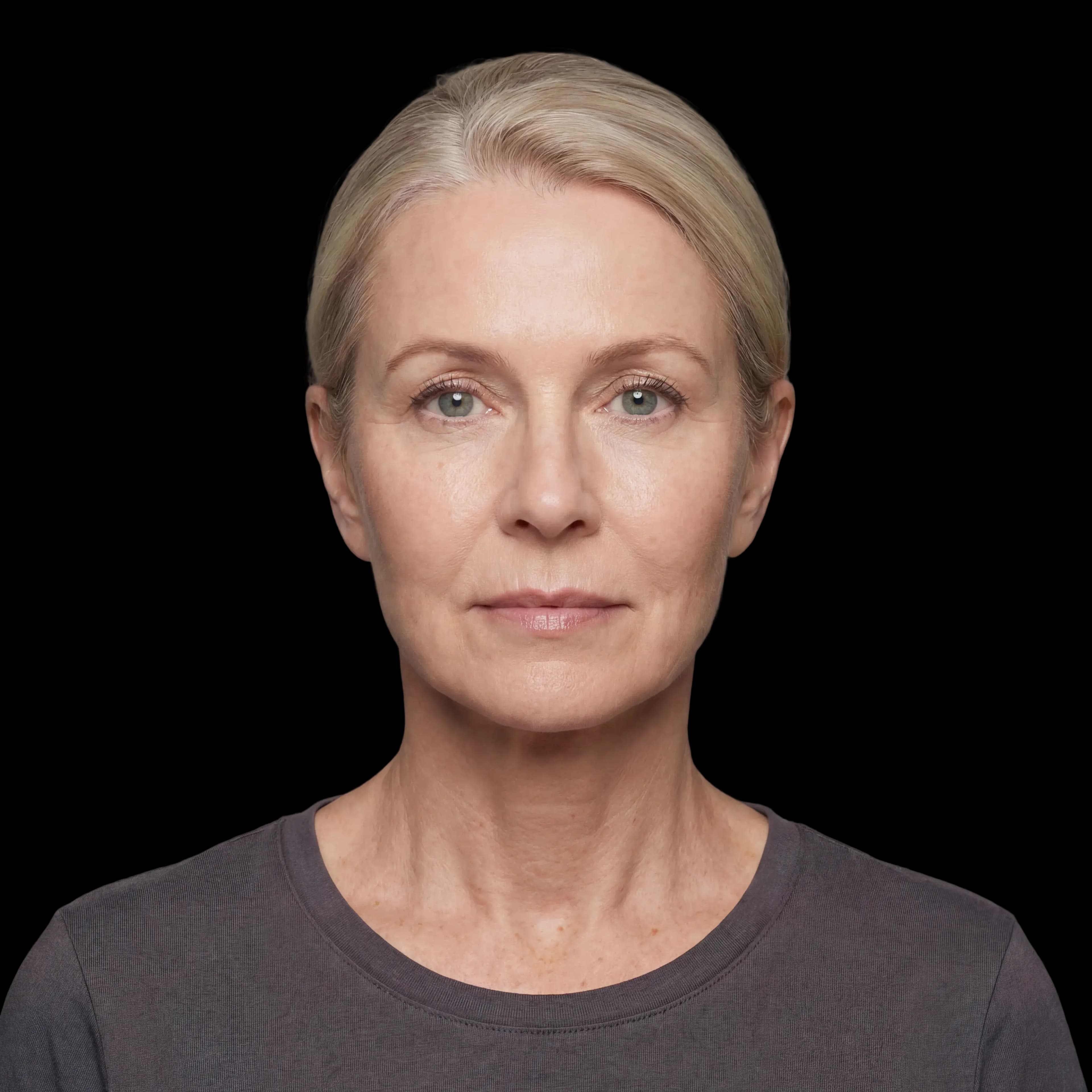 After — representative result