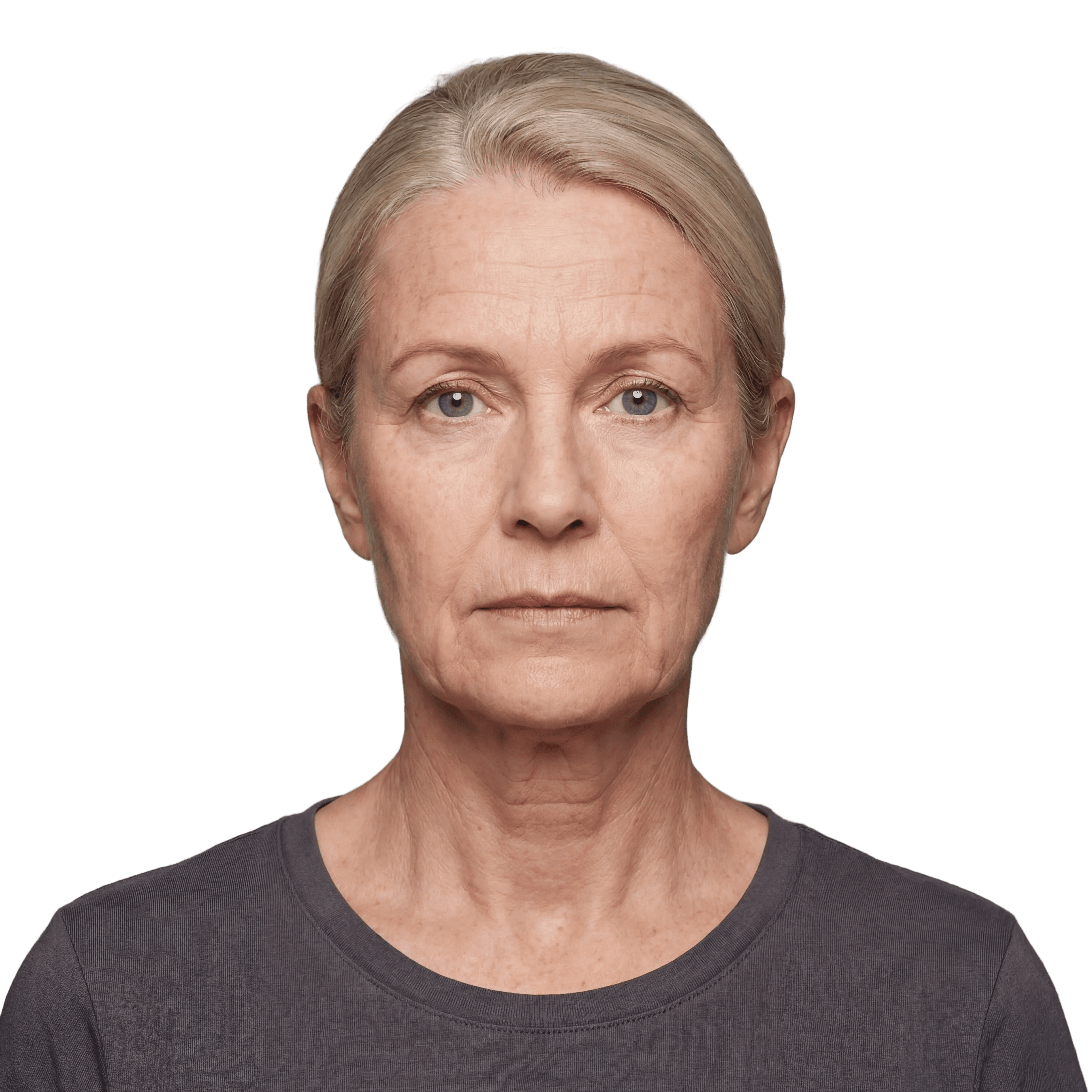 Before — representative result