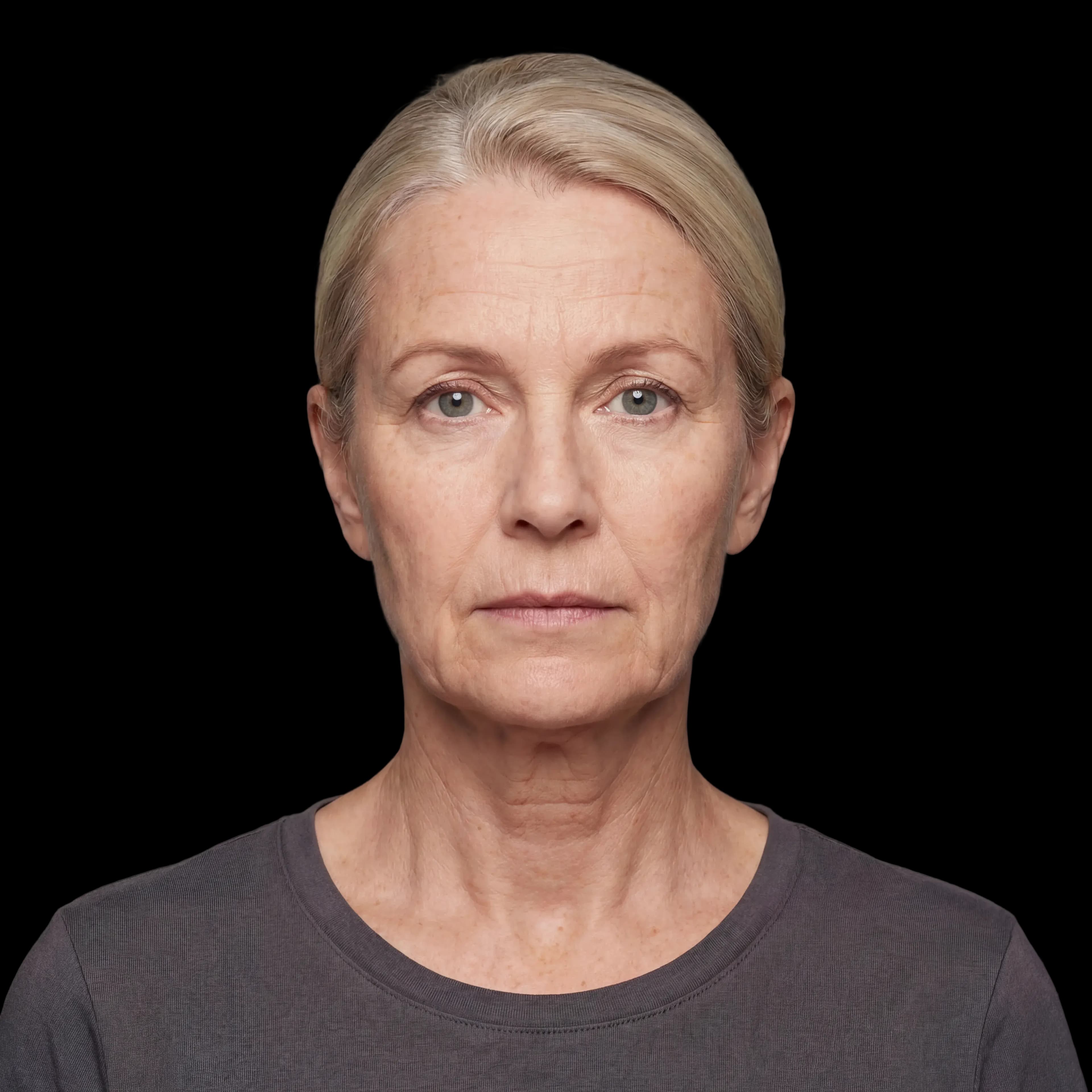 Before — representative result