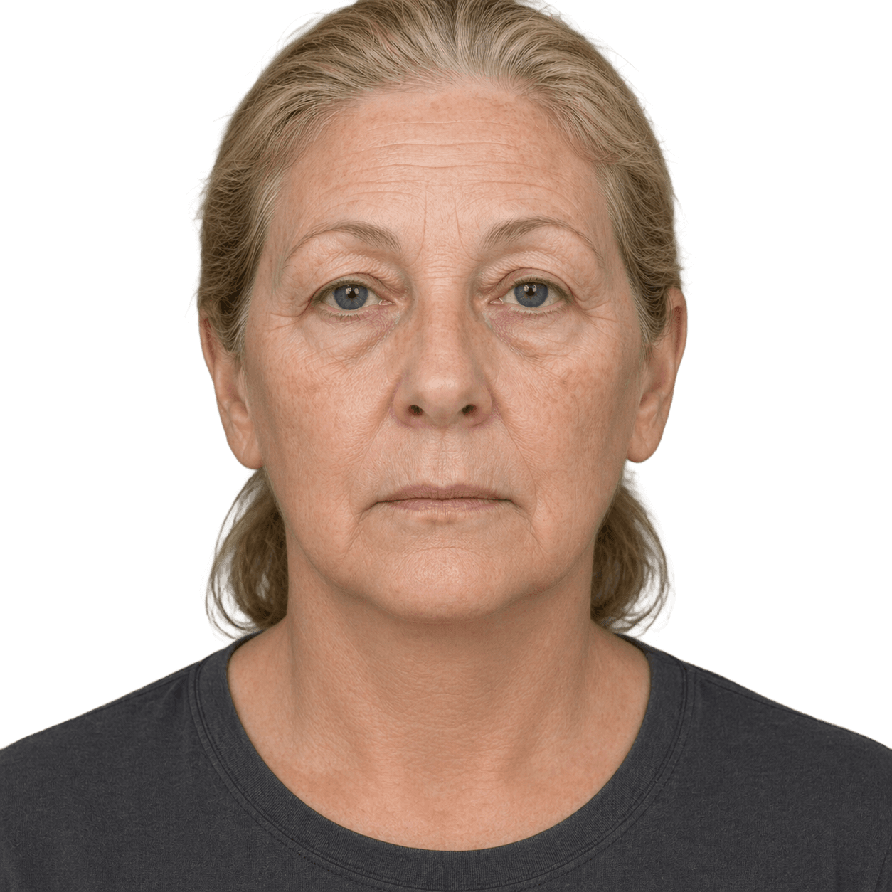 After — representative result