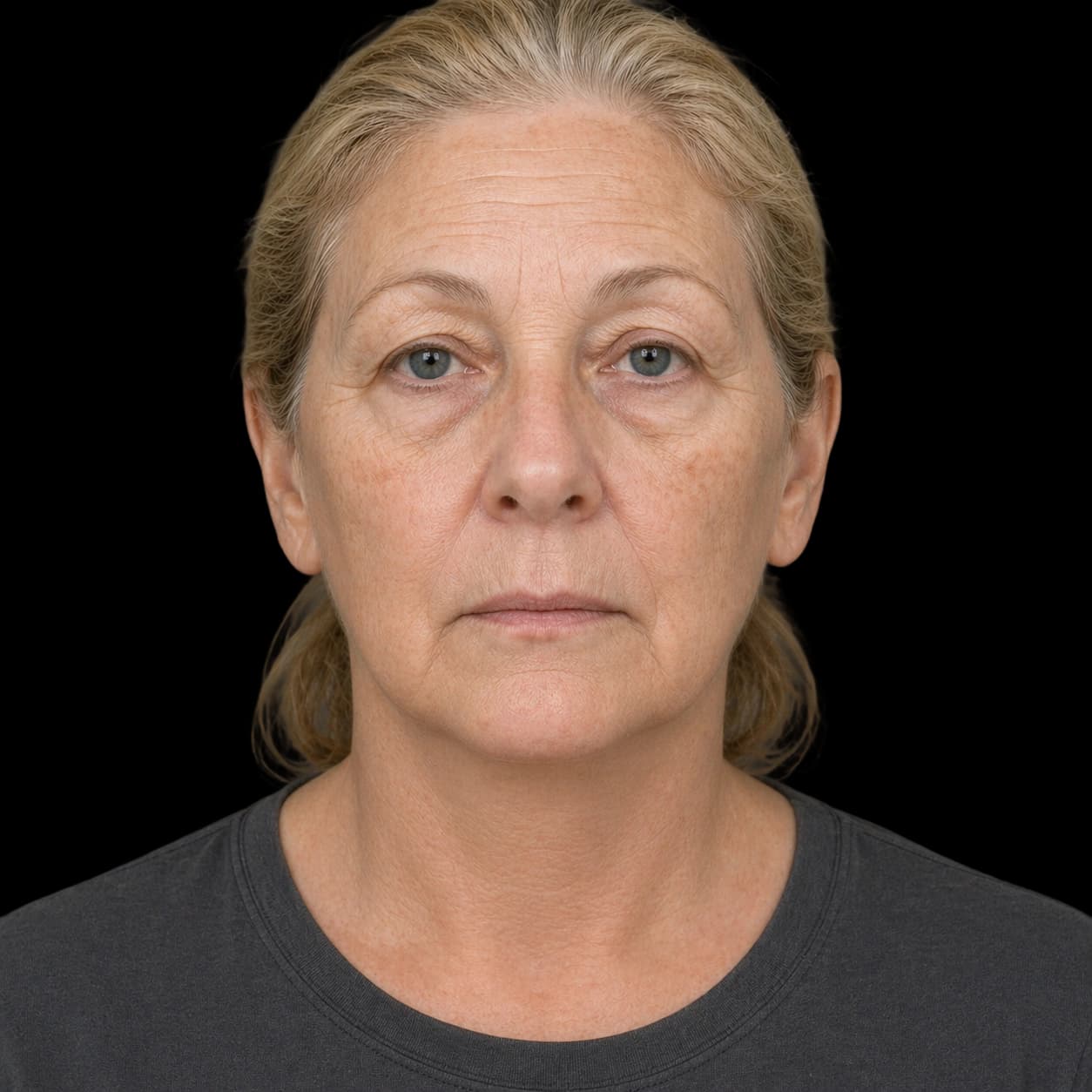 After — representative result