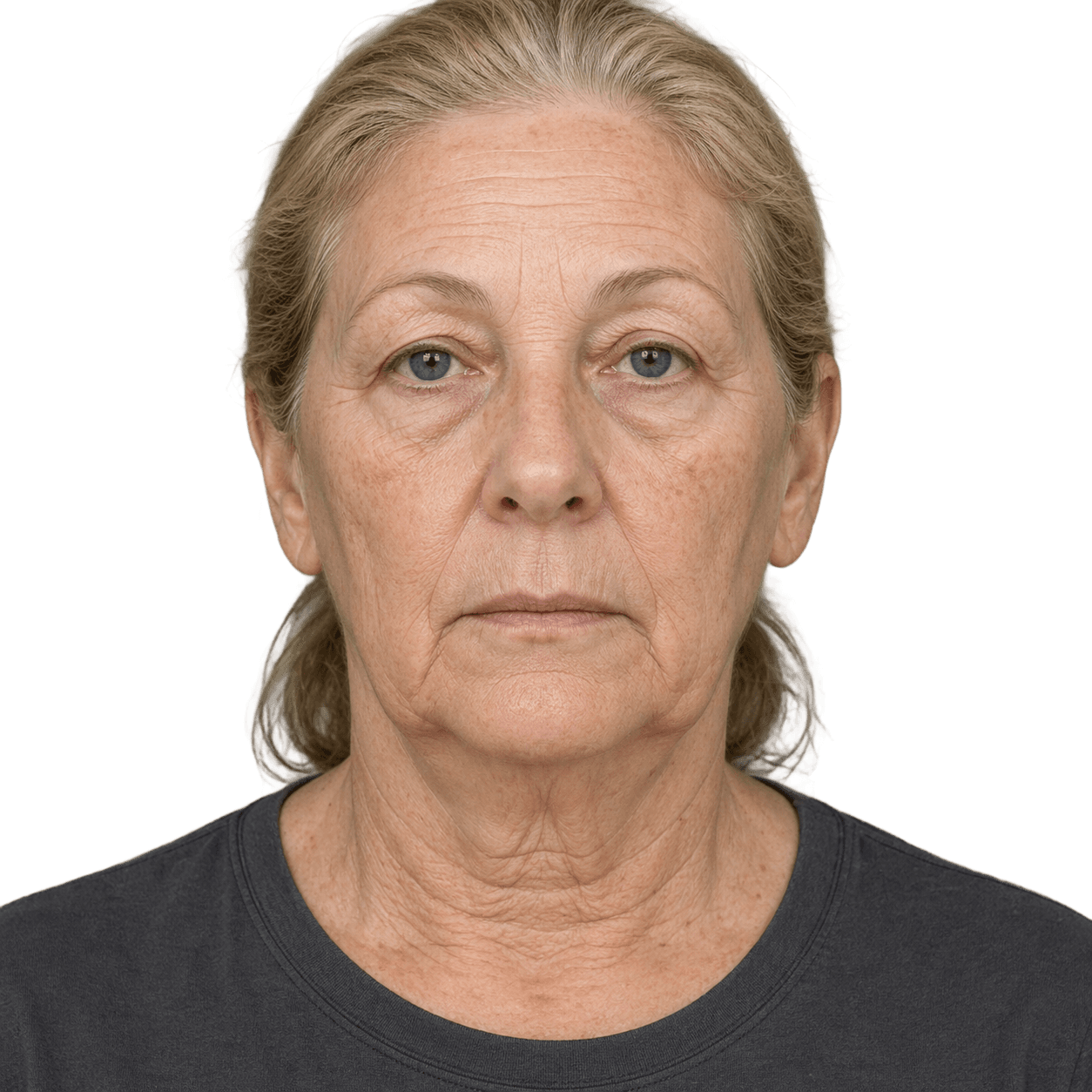 Before — representative result