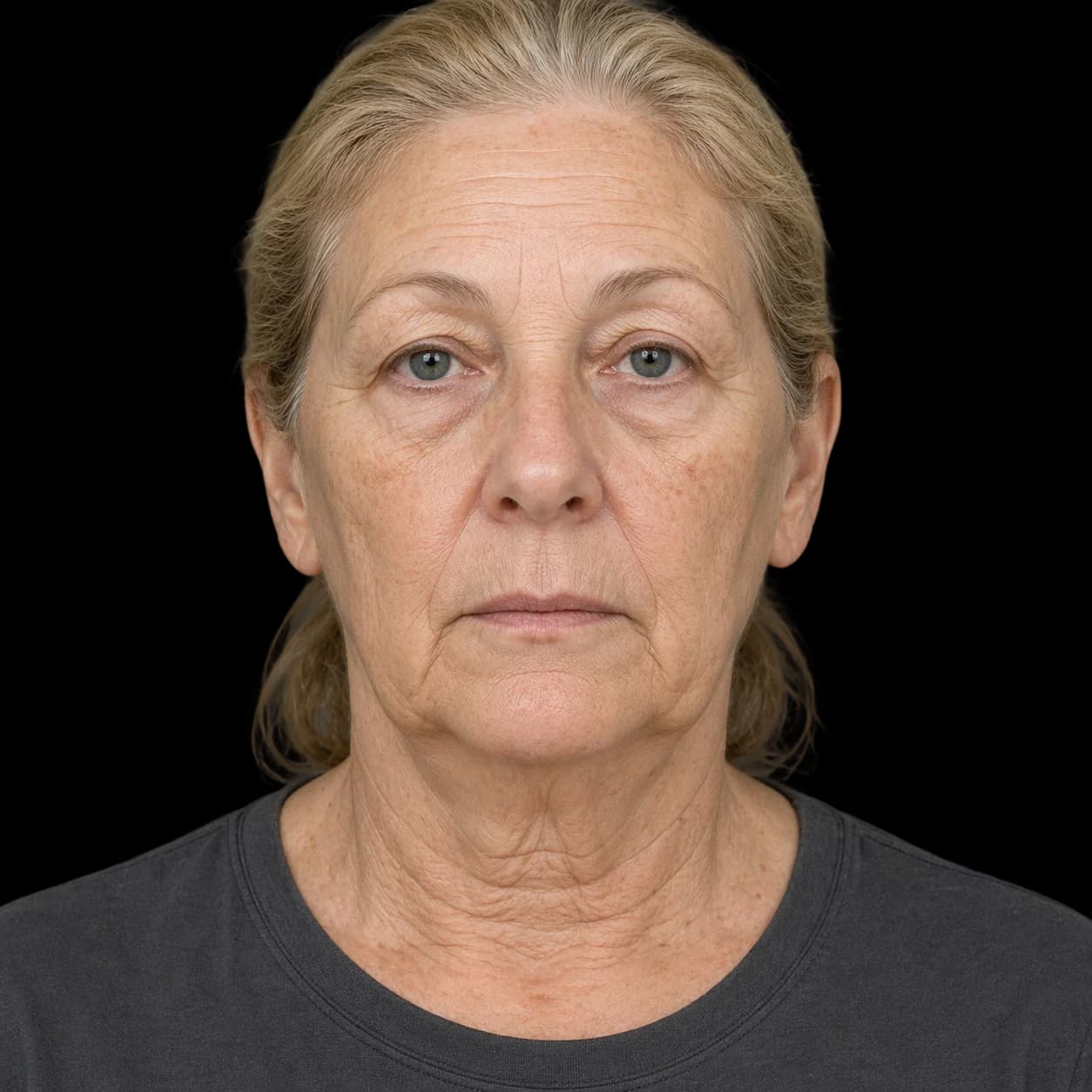 Before — representative result