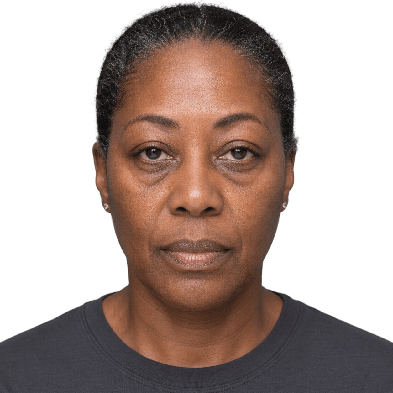 After — representative result