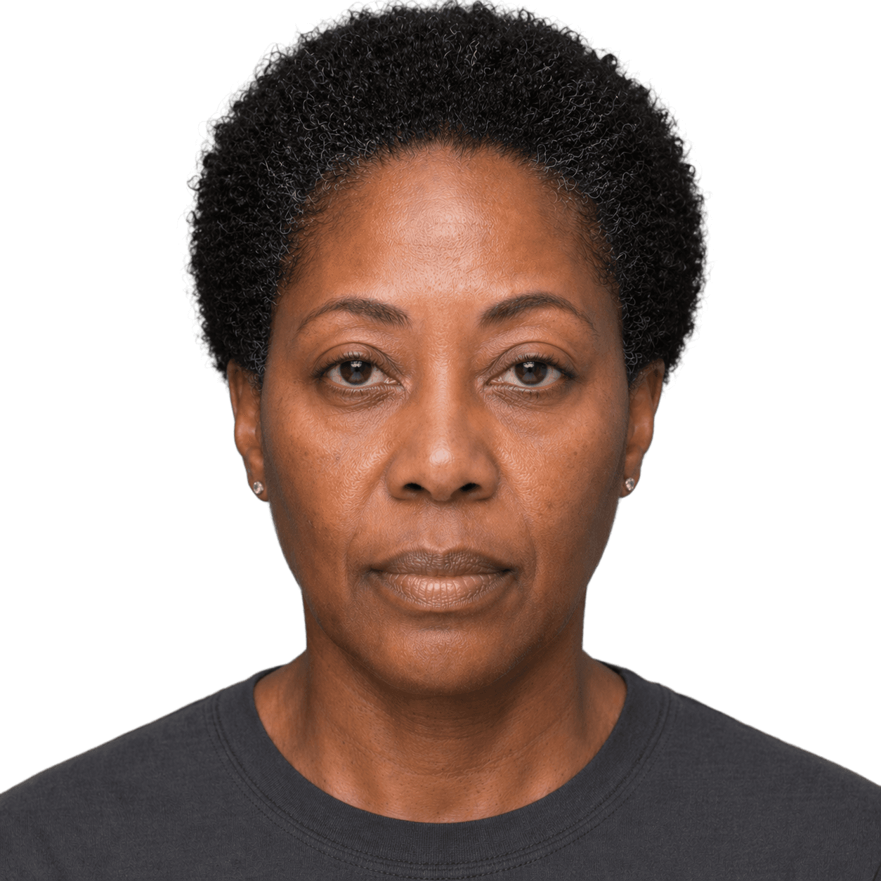 Before — representative result