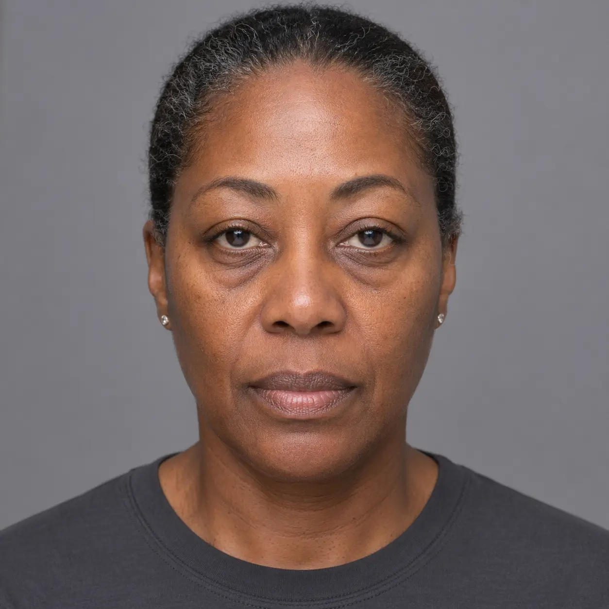 Before — representative result