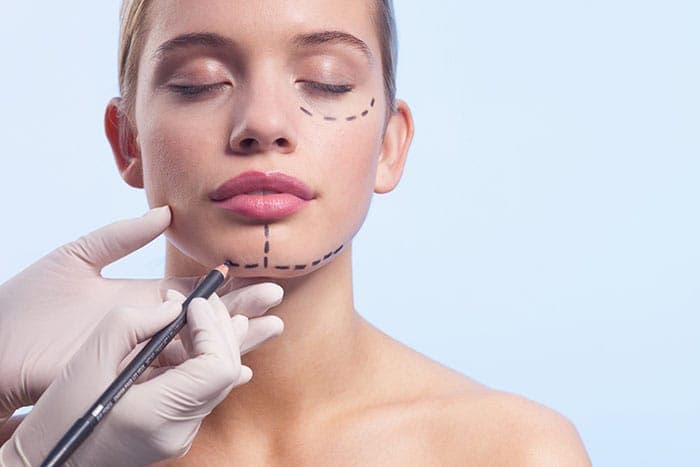 Procedural Seasonality in Cosmetic Surgery Interest – A 12-Month Search Behavior Analysis