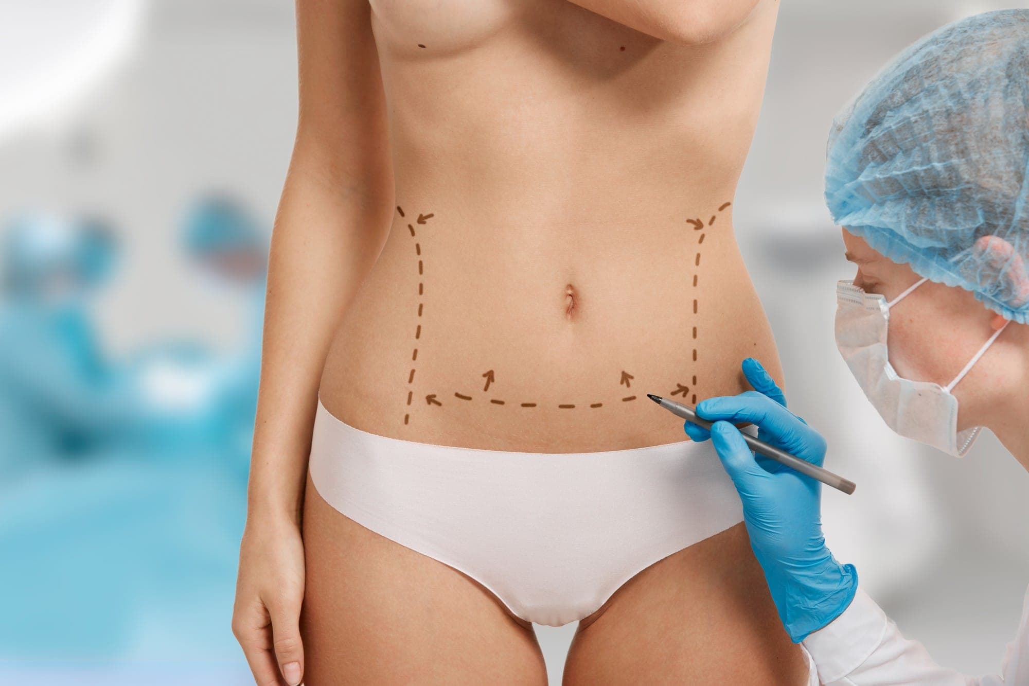 Post-Pregnancy Surgery in LA: 2025 Recovery Guide