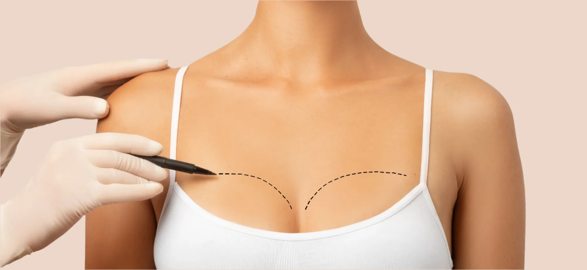 Breast Lift in Nashville, TN (2025 Guide)