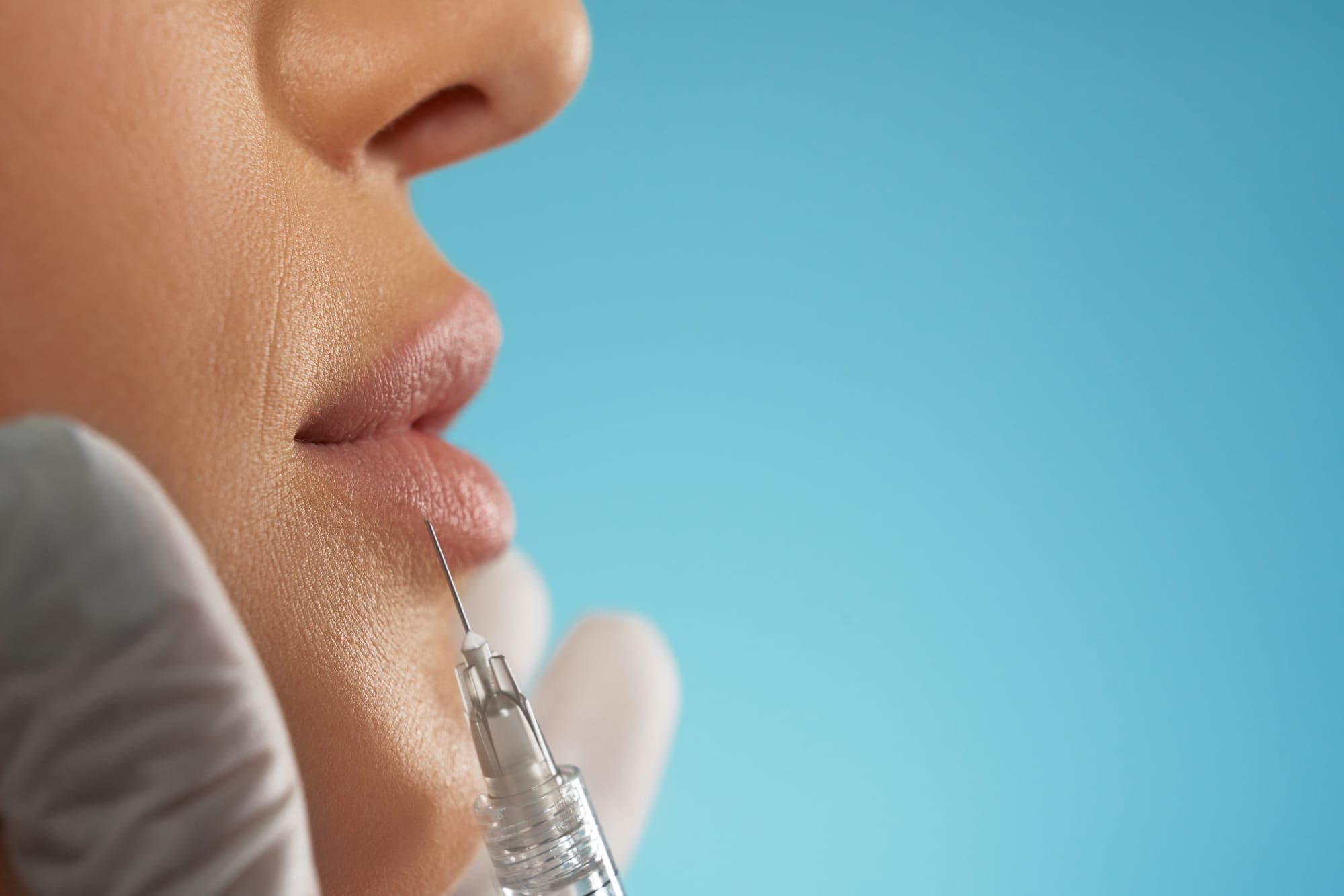 Lip Filler in Miami (2025 Guide)