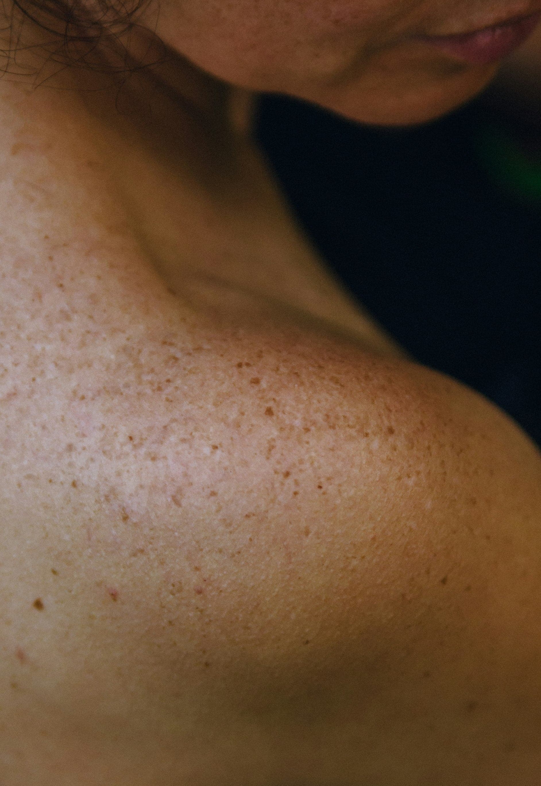 Skin Rejuvenation and Resurfacing Cost in Houston (2025 Guide)