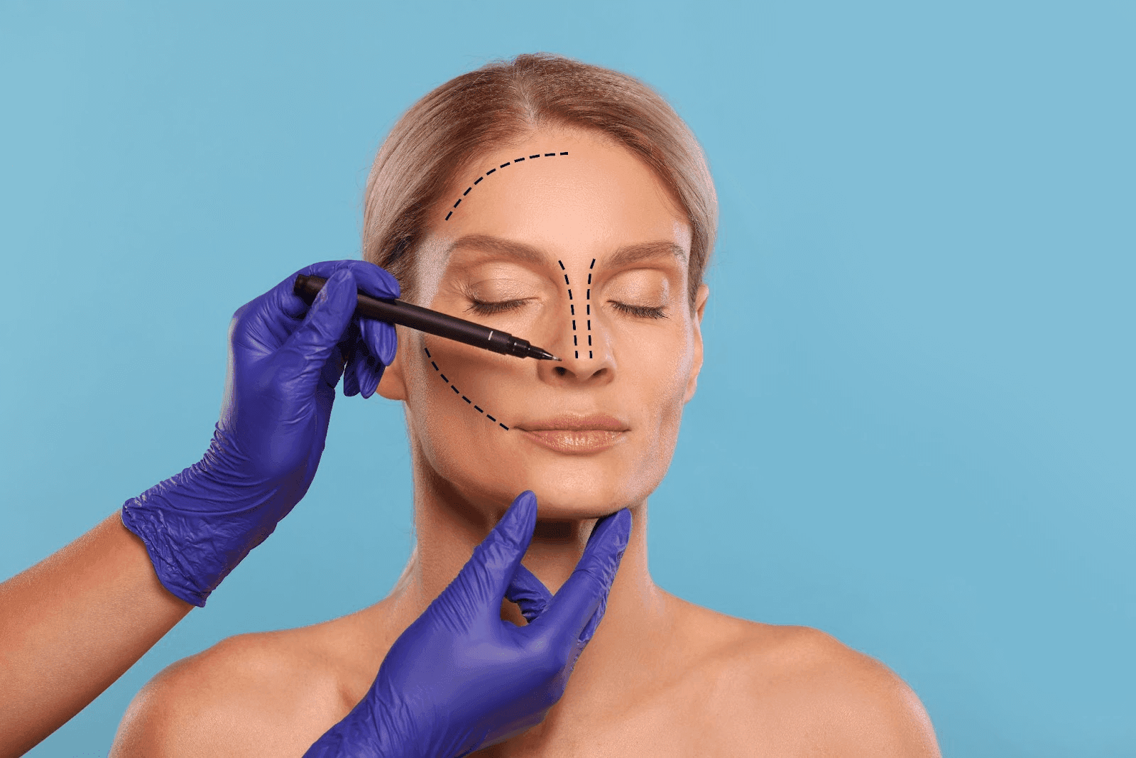 Facelift Cost in Atlanta (2025 Guide)