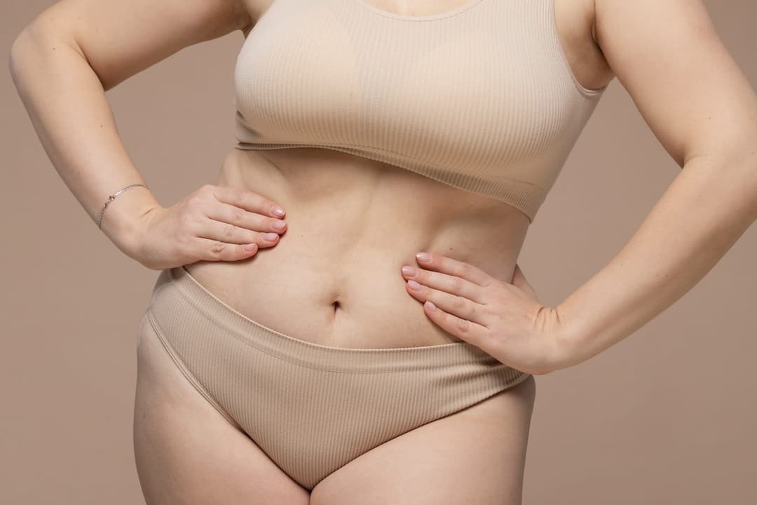 Am I a Good Candidate for a Tummy Tuck (Abdominoplasty)?