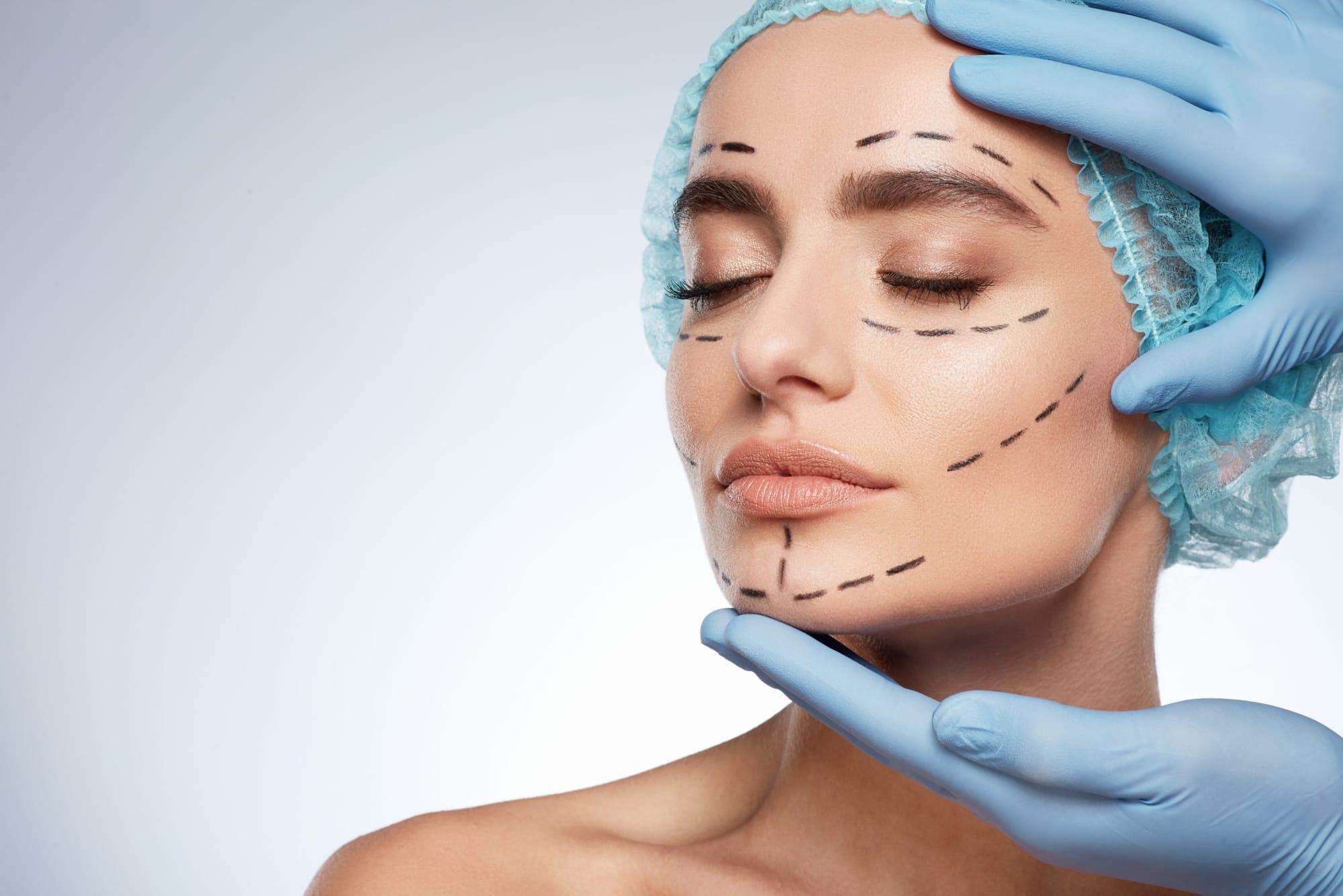 Am I a Good Candidate for a Facelift?