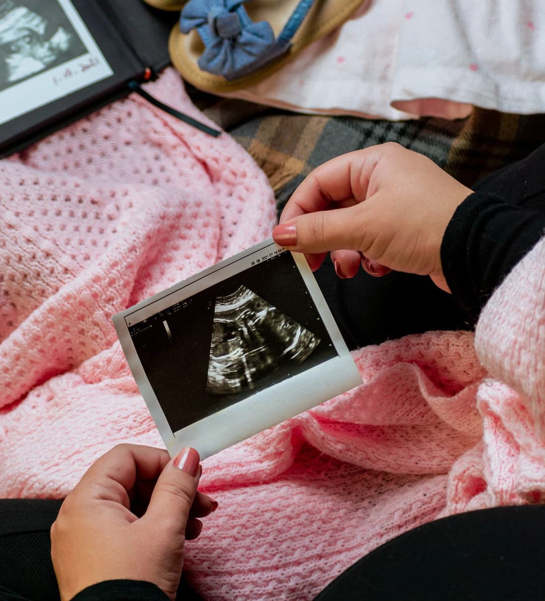 Can I Get a Mommy Makeover Before Having Kids?