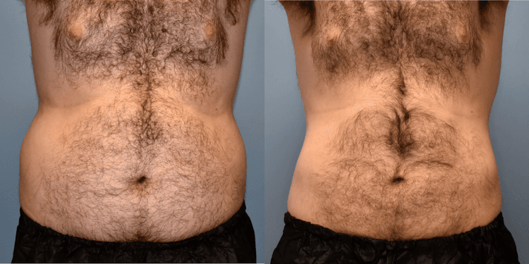 procedure-image