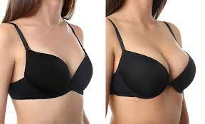 Breast Augmentation procedure image